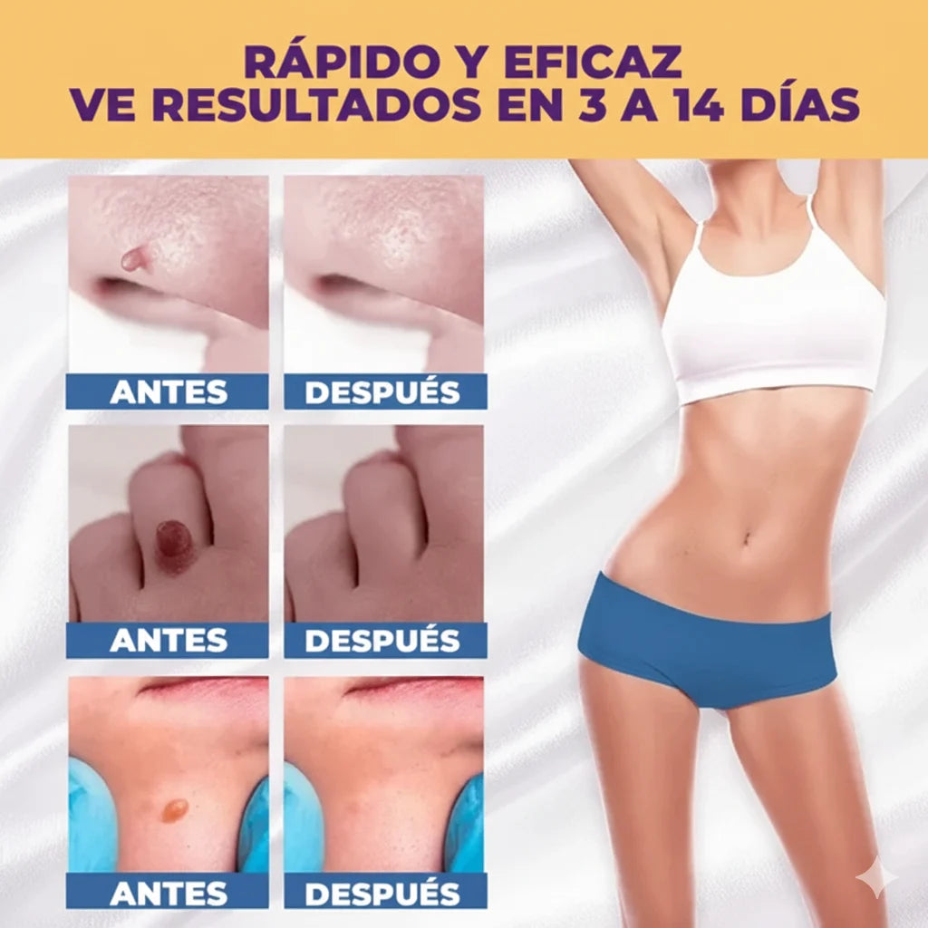 El Eliminador Definitivo de Verrugas - Bee Pure + REGALO GRATIS