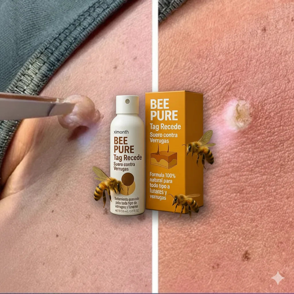 El Eliminador Definitivo de Verrugas - Bee Pure + REGALO GRATIS